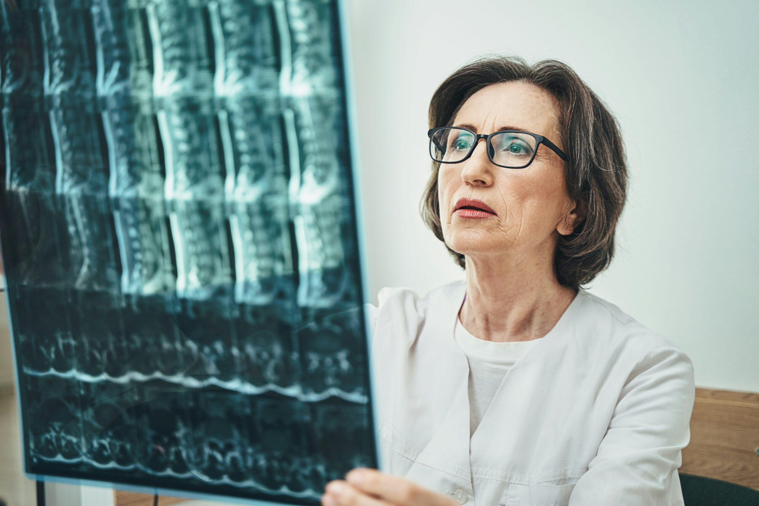 New York Spinal Cord Injury Lawyer
